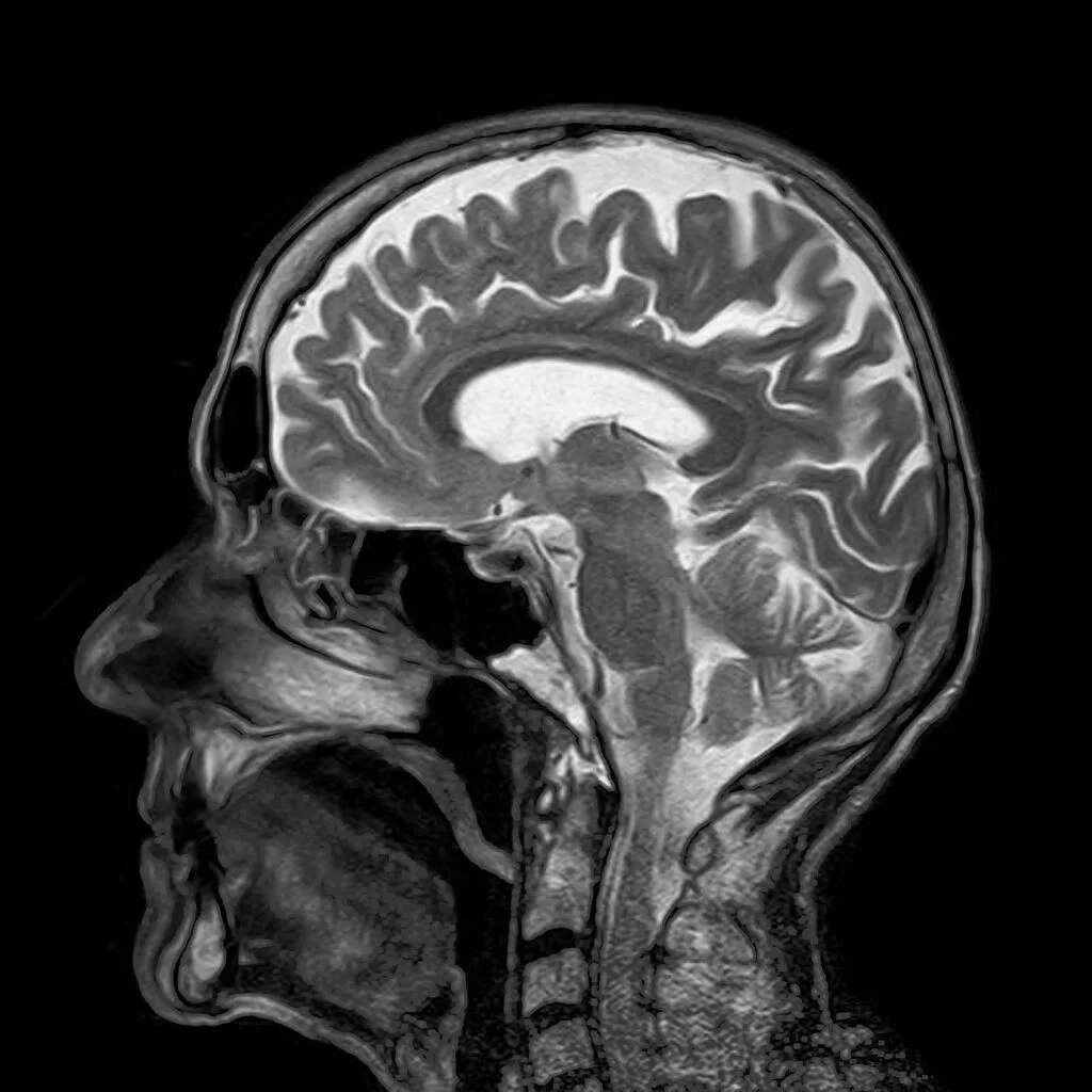 Mri Magnetic X Ray Skull Head - toubibe / Pixabay