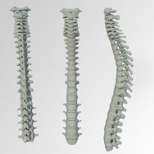 Spine Bone Back Pain Vertebrae  - kalhh / Pixabay