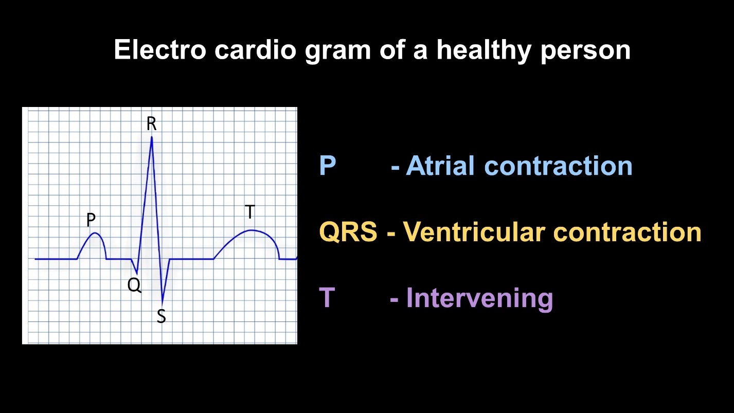 What is an electro Cardio Gram? – ECG – Cardiac cycle (Animal Physiology - BLOOD AND CIRCULATION)