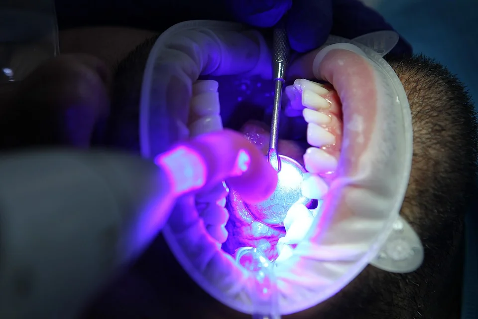 The Advantages and Disadvantages of Deep Cleaning Your Teeth