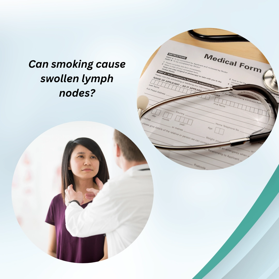 Can smoking cause swollen lymph nodes?