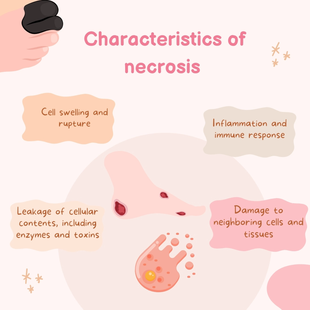 Characteristics of necrosis – Apoptosis vs necrosis