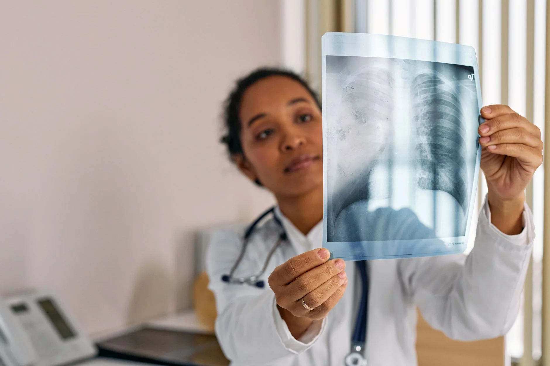 A doctor holding up a chest X-ray of the lungs and looking at it carefully
