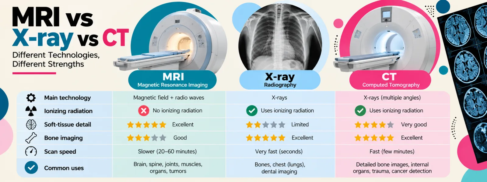 MRI vs X-ray vs CT compared: technology, ionising radiation, soft-tissue detail, bone imaging, scan speed and common uses